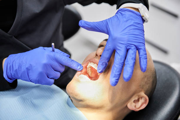 Best Broken Tooth Emergency  in Matta, WA